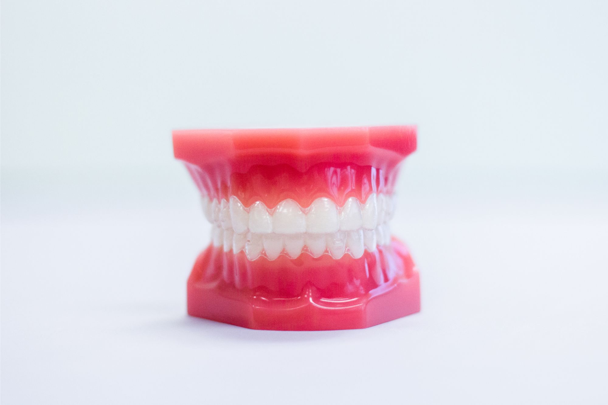 Model of teeth with clear braces, showcasing orthodontic treatment options for improved smiles at Orthodontic Associates.