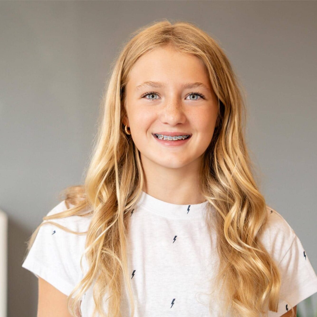 ortho-assoc-patient-09996 birmingham orthodontics